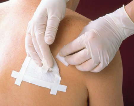 Remove swabs 50 stuks