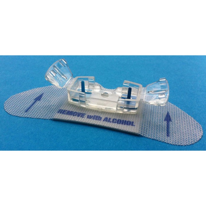 Statlock PICC plus fixatiesysteem - 5 stuks