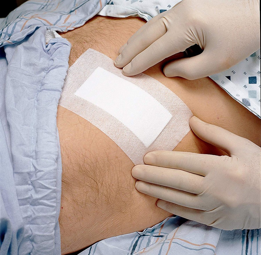 Medipore + Pad - Steriel wondverband