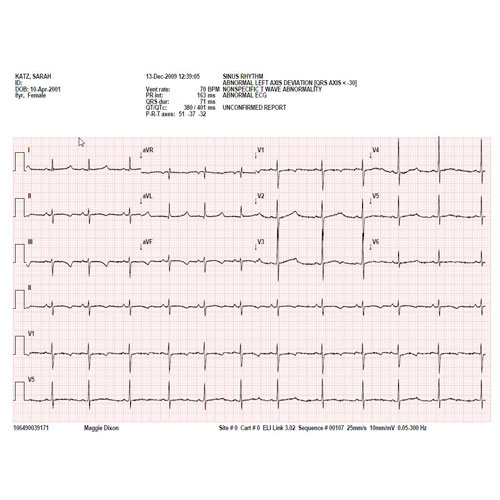 EKG-papier voor Mortara ELi 150 - 108x140mmx 200 - 1 st